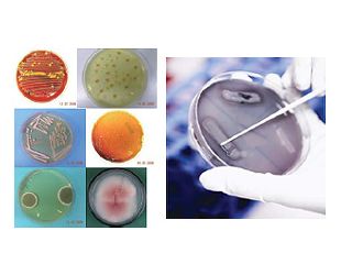 AXIMA Microorganism Identification System